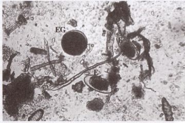 Fig.2: Faecal smear from a captive Geochelone elegans showing gastrointestinal nematode eggs (E - oxyuroid type egg; EG - ascaroid type egg; 10x10
